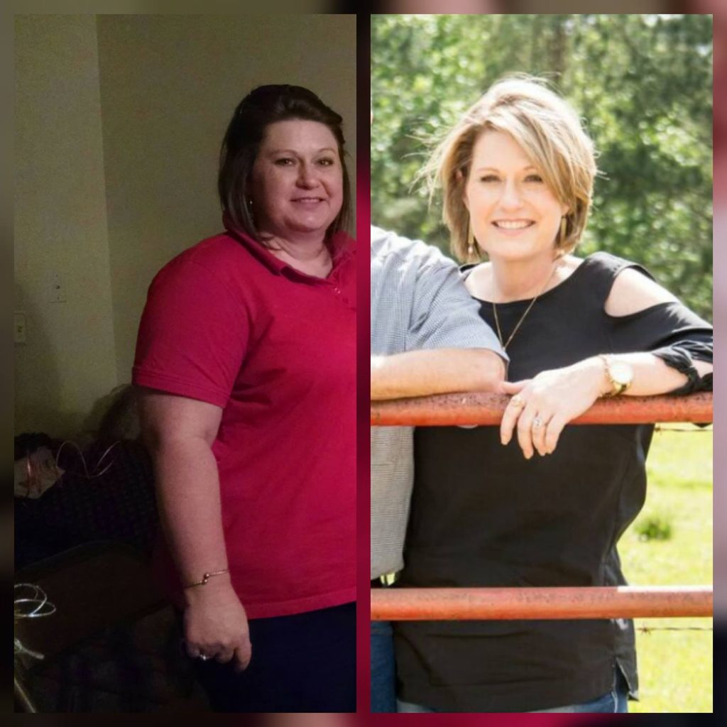 BMIS before after