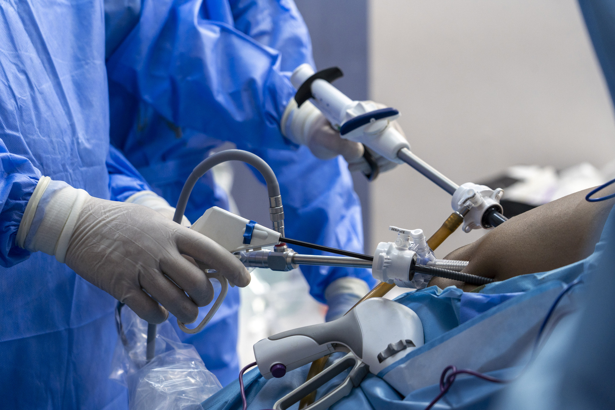 A surgeon reverses a LAP-BAND weight loss surgery